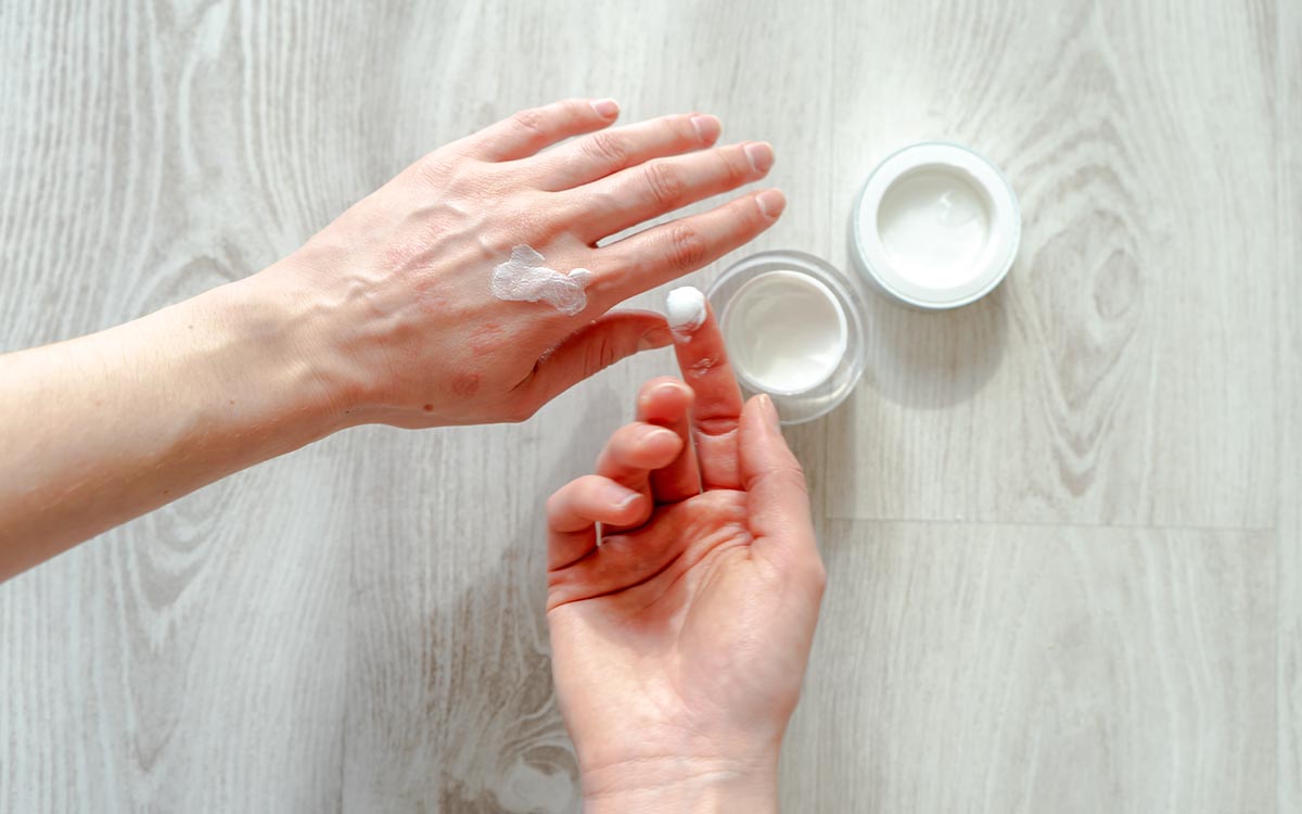 Crema per dermatite atopica, delicata e super efficace